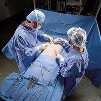 Breast Chest Drape, Fenestrated, Sterile, 100" x 76" x 124", Halyard - 89236 - 1 Each