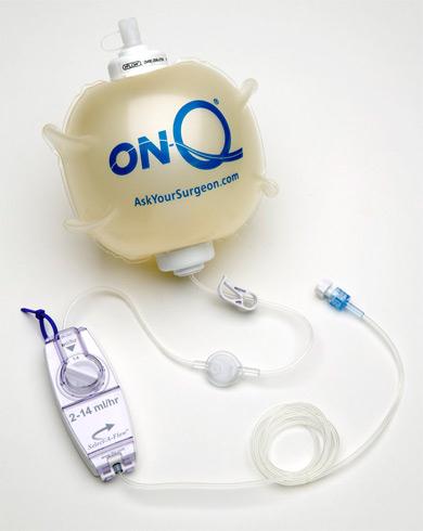 On-Q Painbuster Kits - CB004 - 5 Each - MDL-K-CCB004