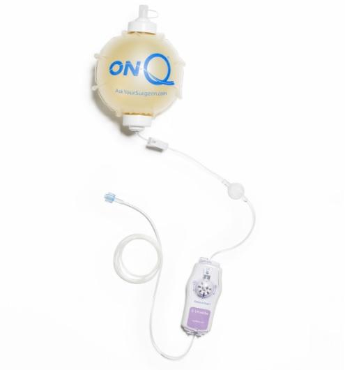 On-Q Pump with Select-A-Flow - CB4007 - 5 Each - MDL-K-CCB4007