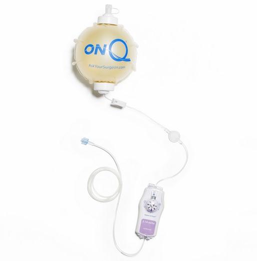 On-Q Pump with Select-A-Flow - CB6007 - 5 Each - MDL-K-CCB6007