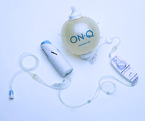 On-Q Painbuster Kits - PM012-A - 5 Each - MDL-K-CPM012A