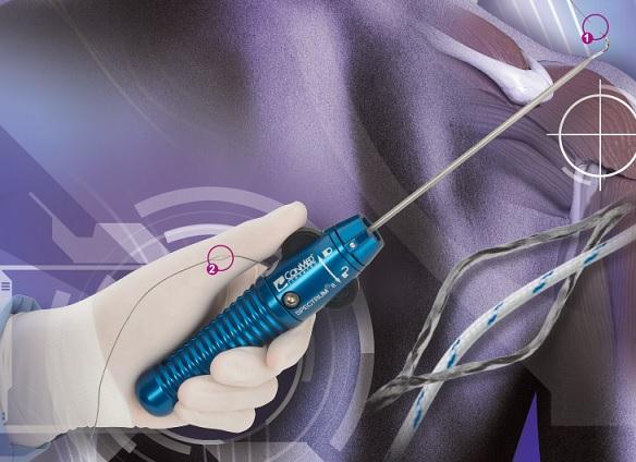 Conmed Super Shuttle Suture Passers - C6005 - 8 Each - MDL-LNVC6005