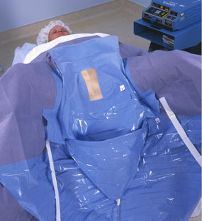 ECOLAB Ecolab Underbuttock Drapes 2993 20 Each - MDL-MCK2993