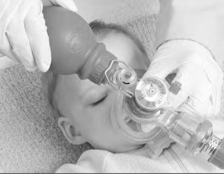 MERCURY MEDICAL Mercury Medical Infant CPR Bag with Cushion Mask 10-55141 6 Each - MDL-MCM1055141