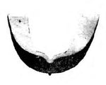 Mercury Medical Gardent-Style Tooth Protector 10-81213 - 1.0 Each - MDL-MCM1081213