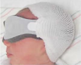 Bili-Bonnet Phototherapy Masks - IX01B - 50 Each - MDL-MCMIX01B