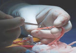 Cardinal Fistula Surgical Drapes - D2264 - 10 Each - MDL-MCTD2264