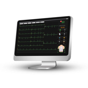 Edan Instruments, Inc ECG Machine with Touch Screen SE-1515 - 1.0 Each - MDL-MDSECGSE1515