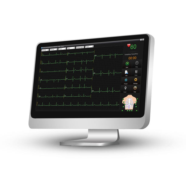 Edan Instruments, Inc ECG Machine with Touch Screen SE-1515 - 1.0 Each - MDL-MDSECGSE1515