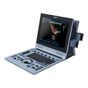 Edan Instruments, Inc U50 and U60 Ultrasound Systems U60 1.0 Each-MDL-MDSU60