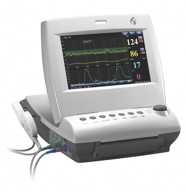 Medgyn Products, Inc F Series Fetal Monitors 017120 - 1.0 Each - MDL-MGY017120