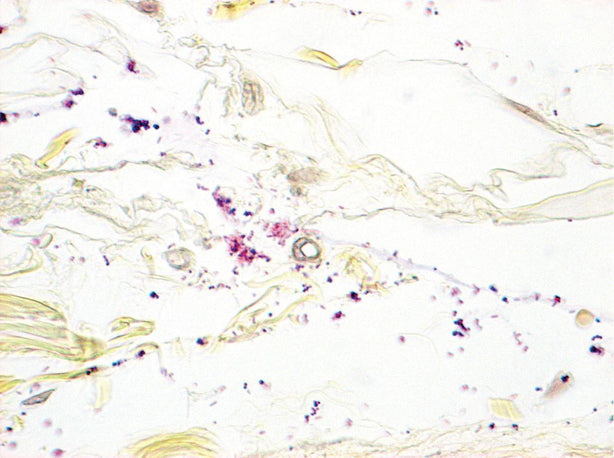 MARKETLAB INC. McDonald Gram Stain Kit 7221 1 Each-MDL-MKA7221