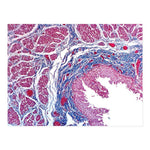 Masson Trichrome Stain Kit - 7225 - 1 Each - MDL-MKA7225