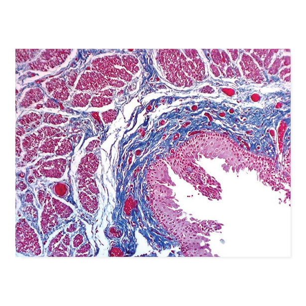 Masson Trichrome Stain Kit - 7225 - 1 Each - MDL-MKA7225