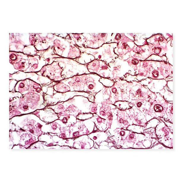 Marketlab Inc. Chandler Reticulum Stain Kit - MKA7239