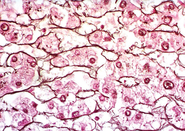 Marketlab Inc. Chandler Reticulum Stain Kit - MKA7240