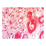 Congo Red Amyloid Stain Kit - 7243 - 1 Each - MDL-MKA7243