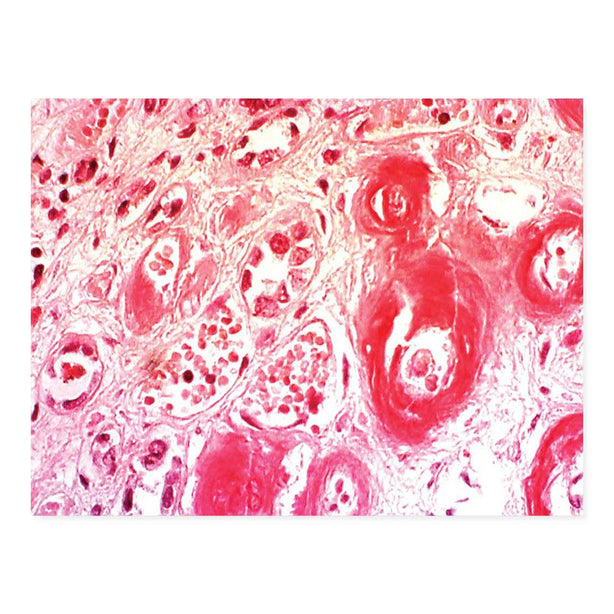 Congo Red Amyloid Stain Kit - 7243 - 1 Each - MDL-MKA7243