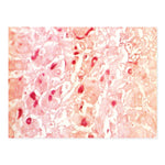 Hepatitis B Stain Kit - 7260 - 1 Each - MDL-MKA7260