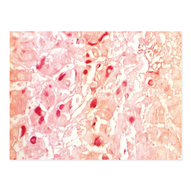 Hepatitis B Stain Kit - 7260 - 1 Each - MDL-MKA7260