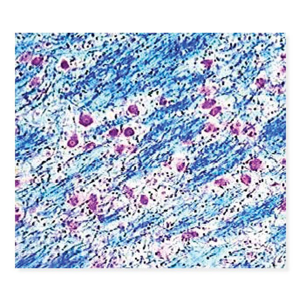 Marketlab Inc. Luxol Fast Blue-CE Violet Kit - MKA7264