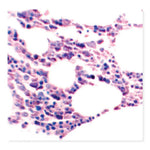 MARKETLAB INC. Optimized Giemsa Stain Kit Kit 7271 1 Each - MDL-MKA7271