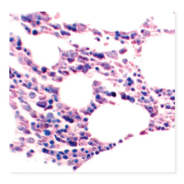 MARKETLAB INC. Optimized Giemsa Stain Kit Kit 7271 1 Each - MDL-MKA7271