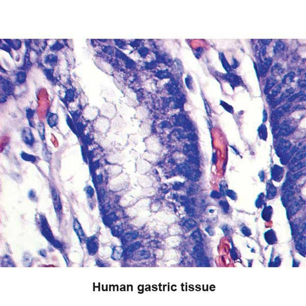 MARKETLAB INC. Optimized Giemsa Stain Kit Kit 7314 25 Each - MDL-MKA7314