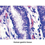 MARKETLAB INC. Optimized Giemsa Stain Kit Kit 7326 25 Each - MDL-MKA7326