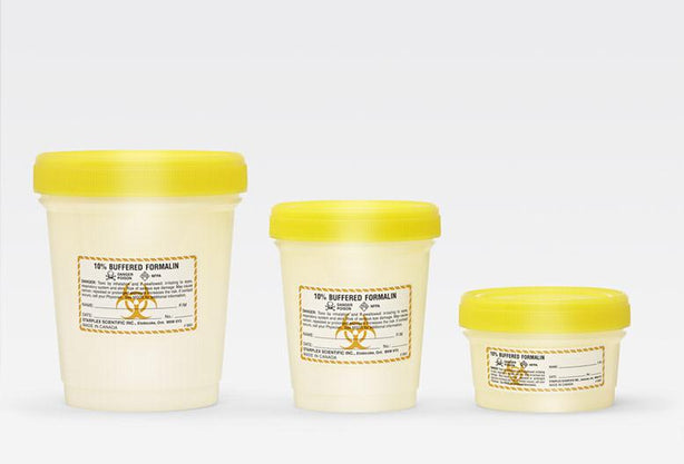 Starplex Scientific Histoplex 250ml-1L Translucent Container with Yellow Screw Cap, Nonsterile, 250 mL - H2502-C - 100 Each