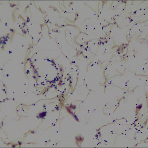 Millipore Corporation Millipore Tissue Gram Stain HT90T-1KT - 1.0 Each