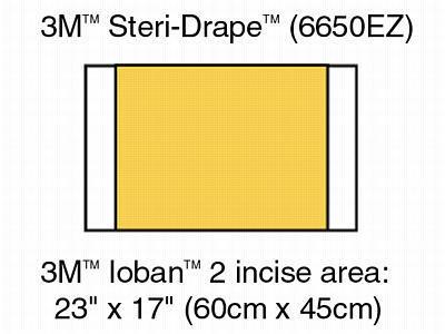 3M 3M Ioban 2 Antimicrobial Incise Drapes 6650EZ 10 Each