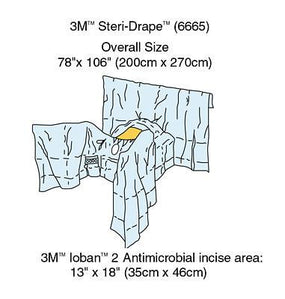3M 3M Abdominal-Perineal 6665 Drapes 6665 5 Each
