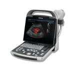 DP-30 Ultrasound Systems - 121-001189-00 - 1 Each - MDL-MND2100118900