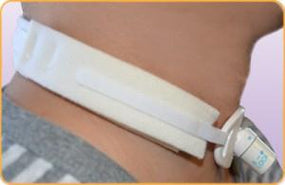 Marpac Inc Marpac 1-Piece Tracheostomy Collars 100B - 100.0 Each