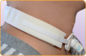 Marpac Inc Marpac 1-Piece Tracheostomy Collars 100B - 100.0 Each