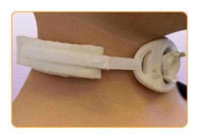 Marpac Inc Pediatric Tracheostomy Collars - MRI100D