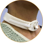 Marpac Inc Two-Piece Tracheostomy Collars 204D - 10.0 Each