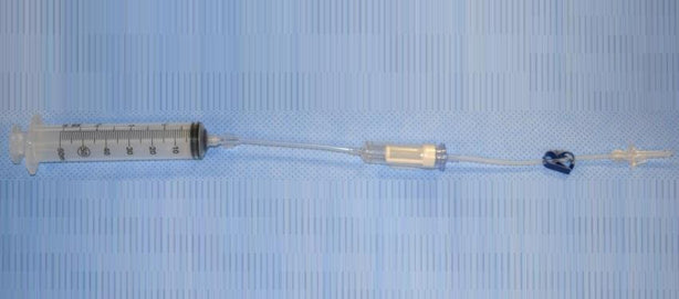 Marian Medical 150 Micron Filter Blood Administration Set with 60 cc Syringe - MRJBASN60150