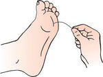 Diabetic Monofilament Tests - B220 - 20 Each - MDL-MZMB220