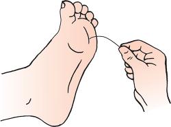 Diabetic Monofilament Tests - B220 - 20 Each - MDL-MZMB220