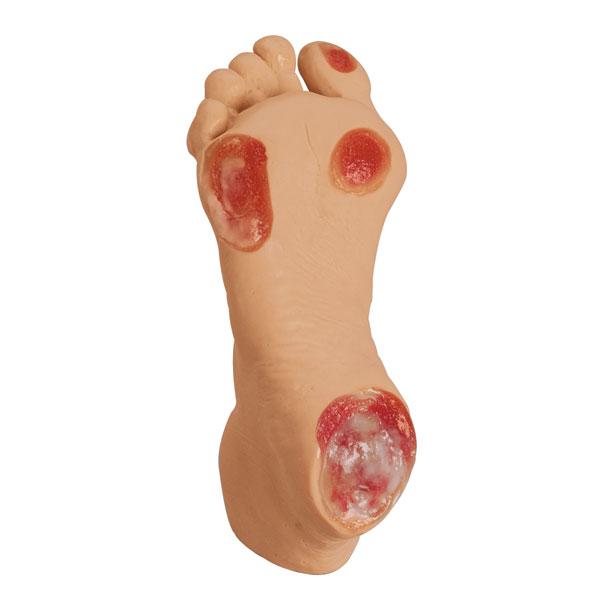 Life/form U Pressure Ulcer Foot Training Model, Elderly, White - LF00933 - 1 Each