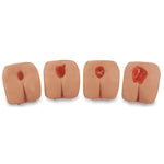 Nasco Healthcare Life / form Pressure Ulcer / Bedsore Models LF00934 U - 1.0 Each