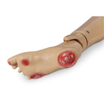 Nasco Optional Pressure LF04041U Life / form Foot Ulcer Patient Care Manikin - MDL-NSCLF04041U - 1 Each