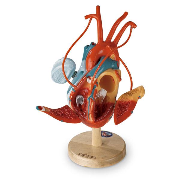Nasco SB29919U Denoyer-Geppert Heart of America Plus with Coronary Bypass Vessels Educational Model - MDL-NSCSB29919U - 1 Each