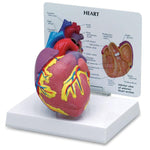 Nasco 2-Piece Heart Model - SB32595U - 1 Each - MDL-NSCSB32595U