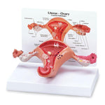 Uterus Educational Model - SB35435U - 1 Each - MDL-NSCSB35435U