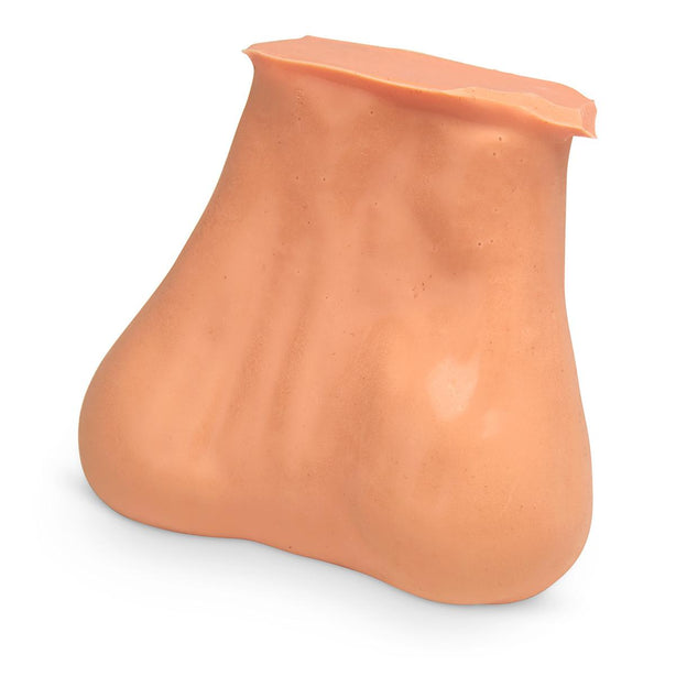 NASCO Training Life-Size Testicle Model with 2 Pathological Lumps, 3-9/16" x 3-1/8" x 1-9/16" - SB41581U - 1 Each