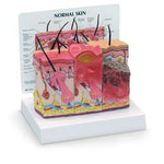 Nasco Healthcare Skin Burn / Normal Educational Training Model SB46482U - 1.0 Each - MDL-NSCSB46482U