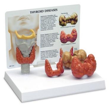 Nasco Healthcare Thyroid Model by Nasco - NSCSB46541U
